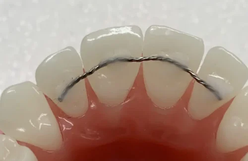 Spalk – Tandarts DeoSmile Spalk - Tandarts DeoSmile